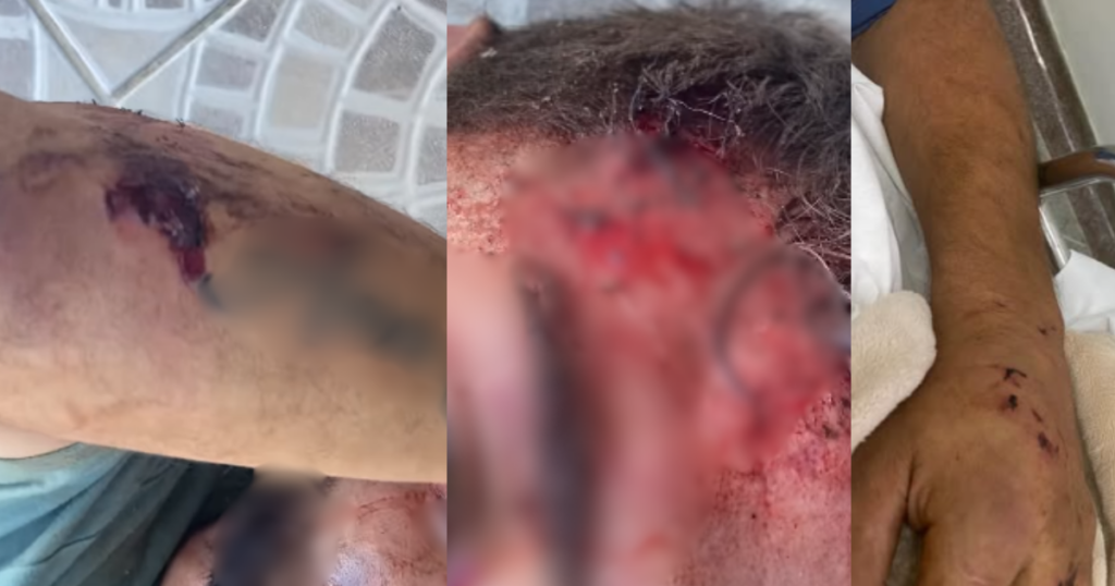 Esposa relata momentos de desespero após agressão contra trabalhador